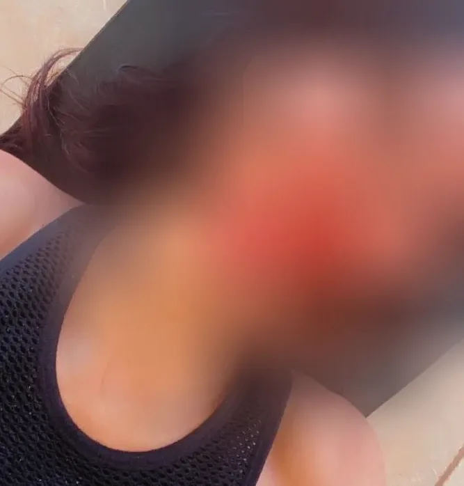 Winnie, 29